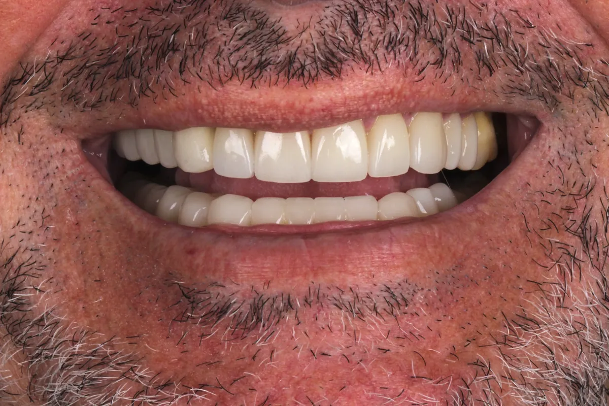 Sorriso antes do tratamento — caso 01